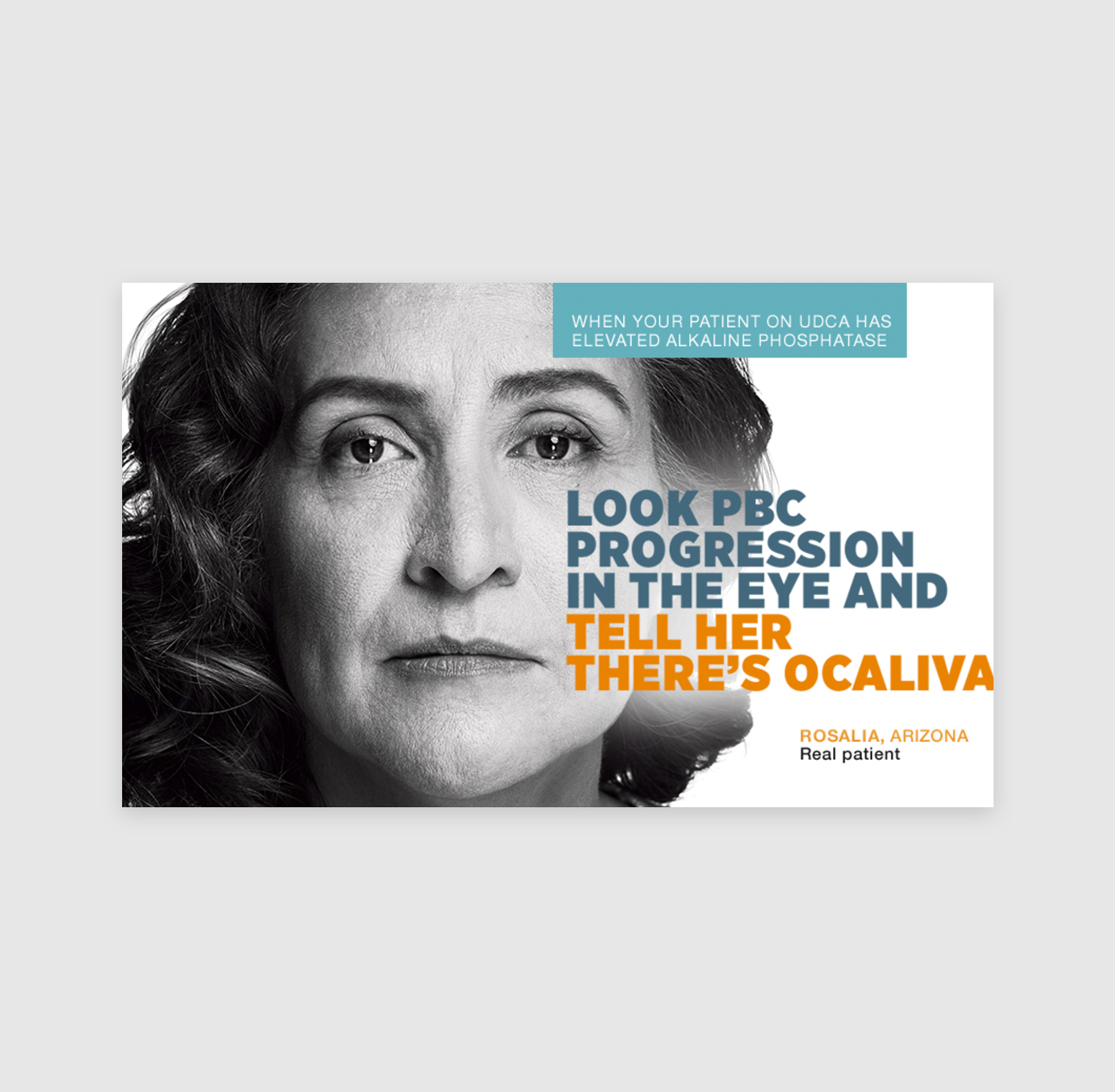 Ocaliva Ad Campaign